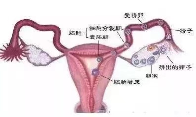 不孕症的 “福影”—— 子宫输卵管超声造影